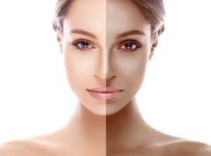 How to De-tan Skin at Home Naturally, Tan removal at home, natural tan removal, home remedy for tanned skin | Cherry On Top